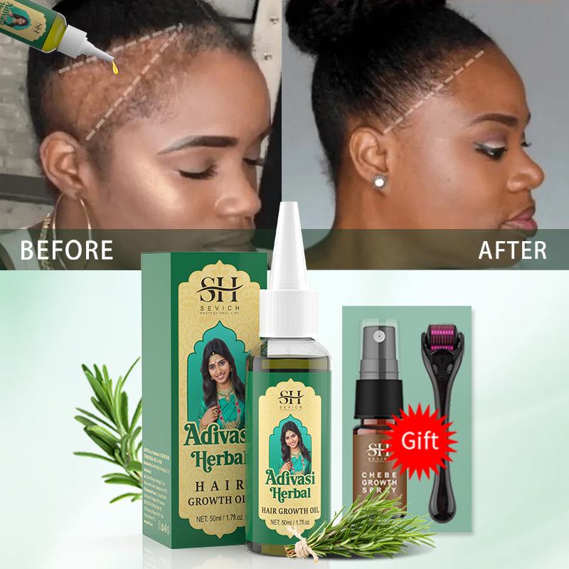 Aceite Ayurvédico para el Crec - Hair Care Fragrance Essential Oil reseña y precio