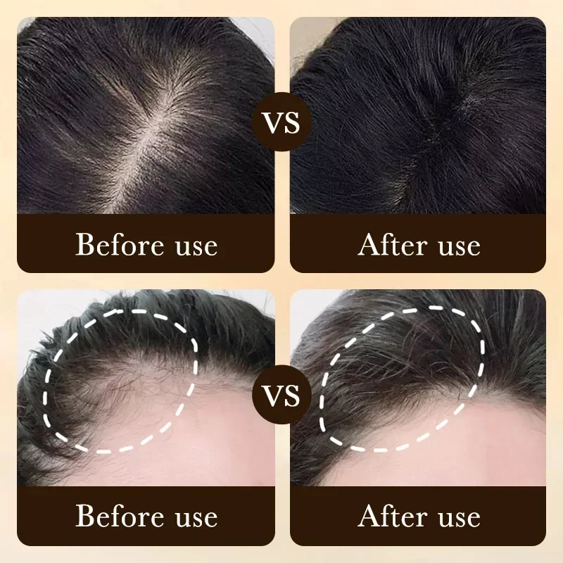 Aceite de Biotina para el Crec - Hair Care Fragrance Essential Oil reseña y precio