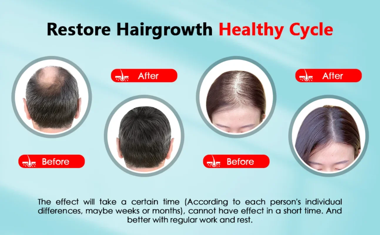 Gorro para el crecimiento del  - Hair Care Basic reseña y precio